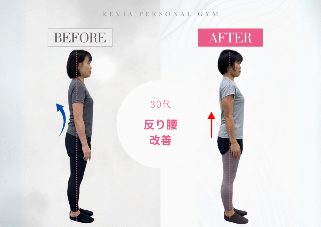 【ビフォーアフター写真あり】30代女性の反り腰改善!女性専門パーソナルジムREVIAでの変化とは?