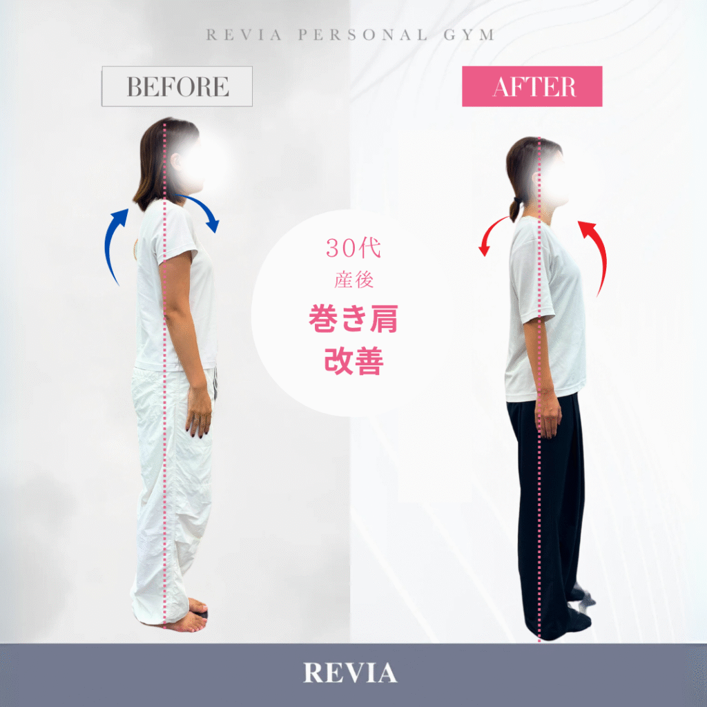 【守谷の女性専用ジム】産後の巻き肩・姿勢改善で自信の持てるカラダに！