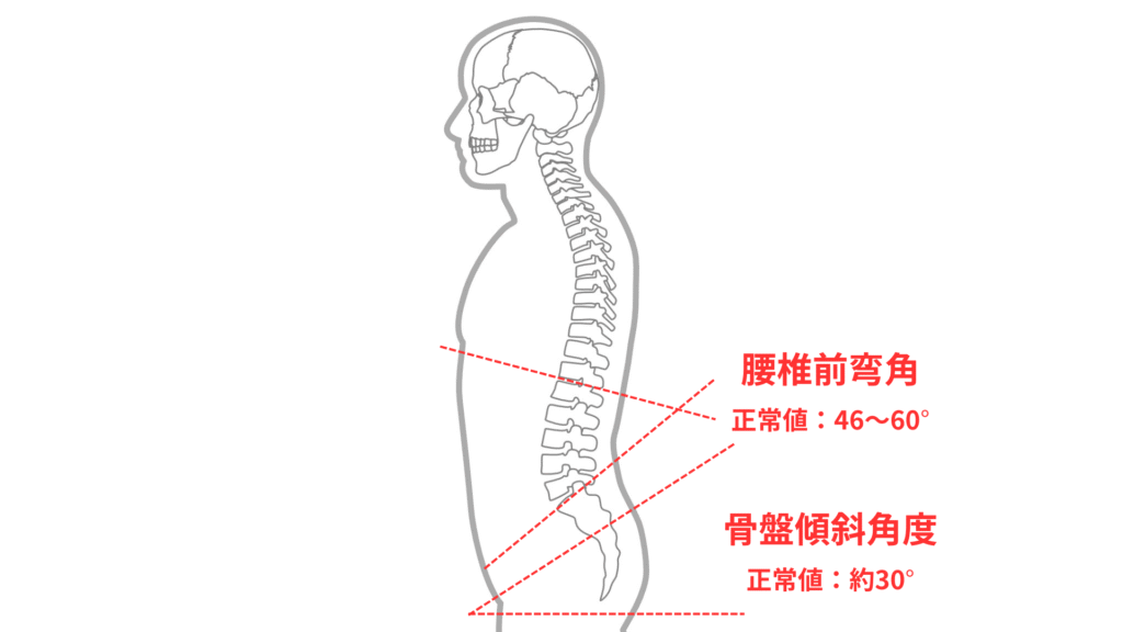 腰椎前弯角と骨盤傾斜角度