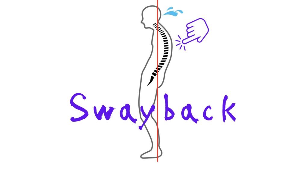 反り腰だけじゃない！女性に多い“スウェイバック”に要注意